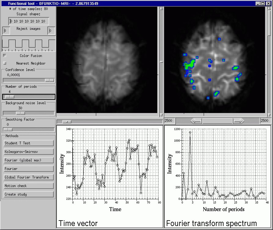 Snapshot of the functional analysis software