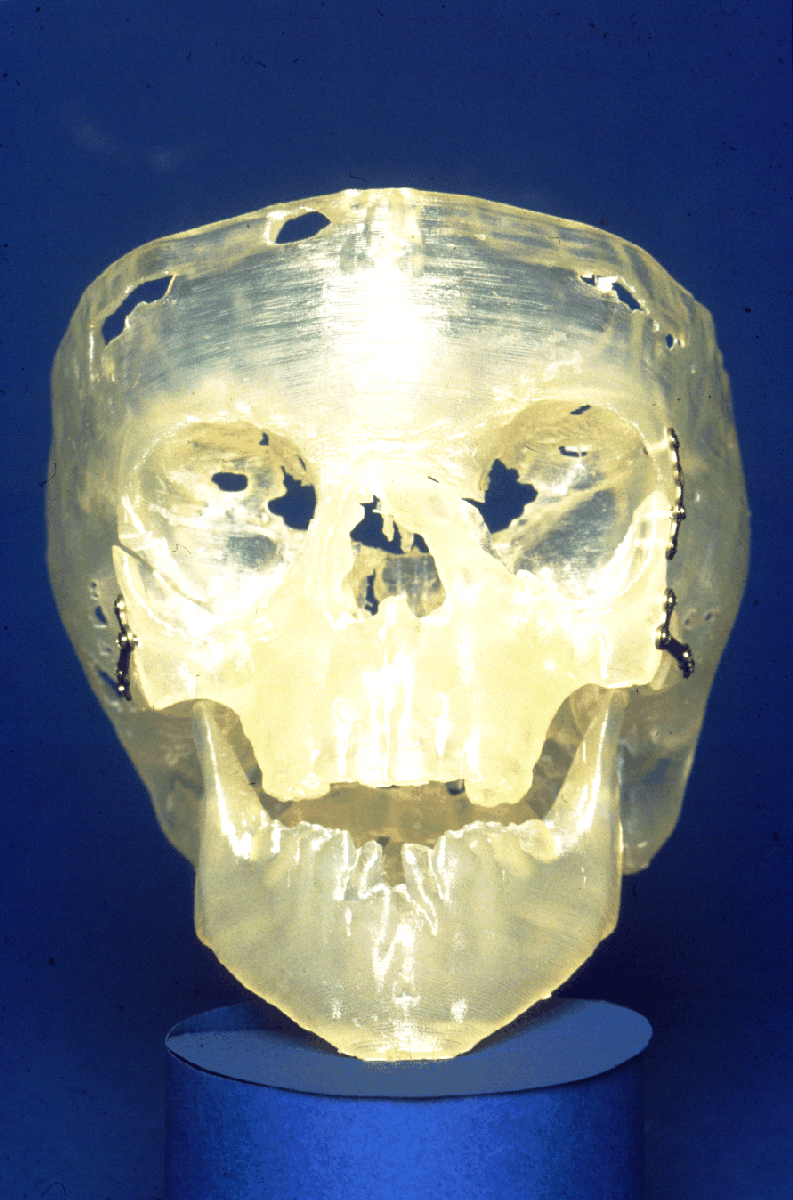 Human skull manufactured using stereolithography